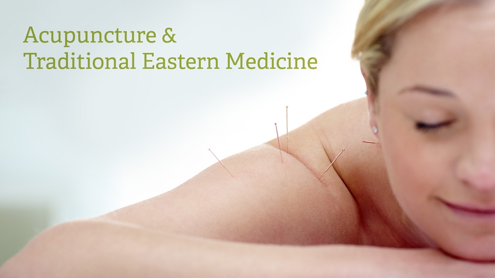 Acupuncture